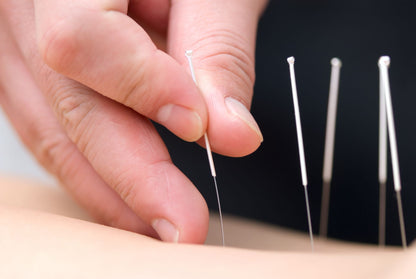 AcuPro needle - 0.30 x 75 mm - Dry Needling - Acupuncture